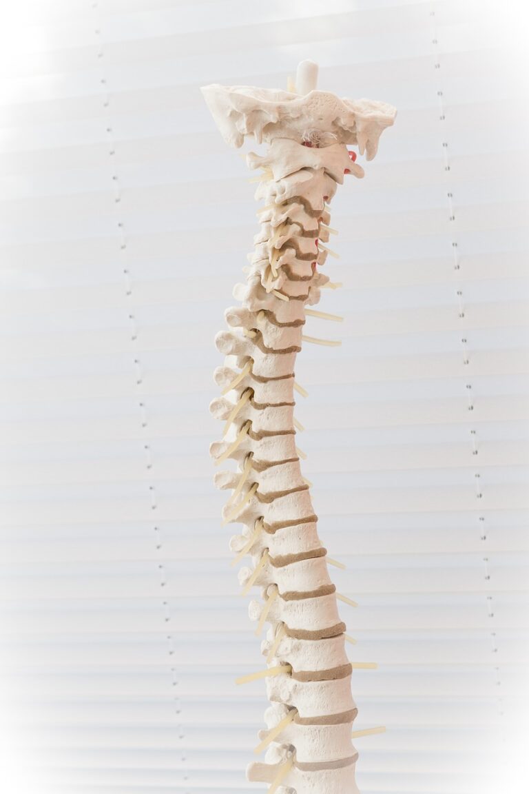 Things to Avoid with Degenerative Disc Disease