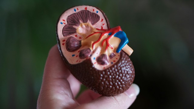 image of a kidney